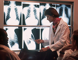 Radiologist viewing chest x-rays.